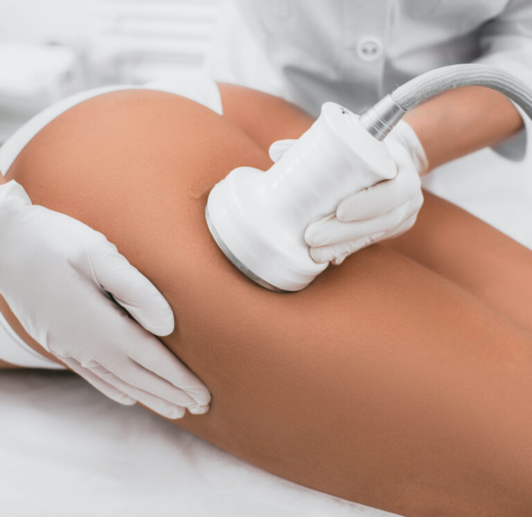 Electrostimulation